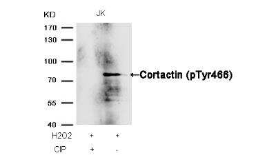 Western Blot: Cortactin [p Tyr466] Antibody [NB100-81871]